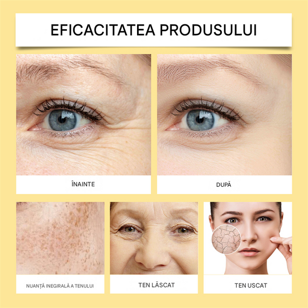 Crema ANTI-IMBATRANIRE cu VENIN de ALBINE