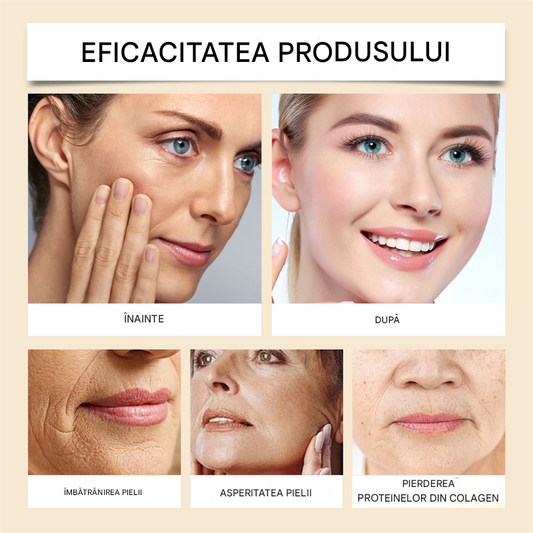 Crema ANTI-IMBATRANIRE cu VENIN de ALBINE