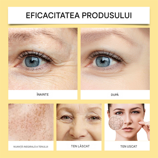 Crema ANTI-IMBATRANIRE cu VENIN de ALBINE