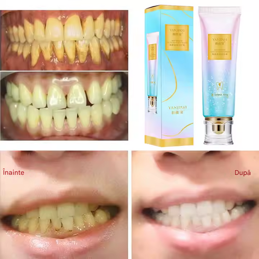 Albire INSTANTA de lunga durata!