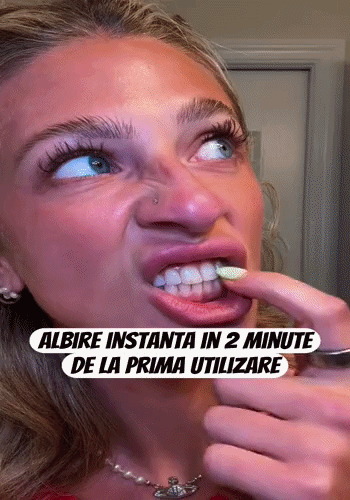 Zâmbet Strălucitor Instant